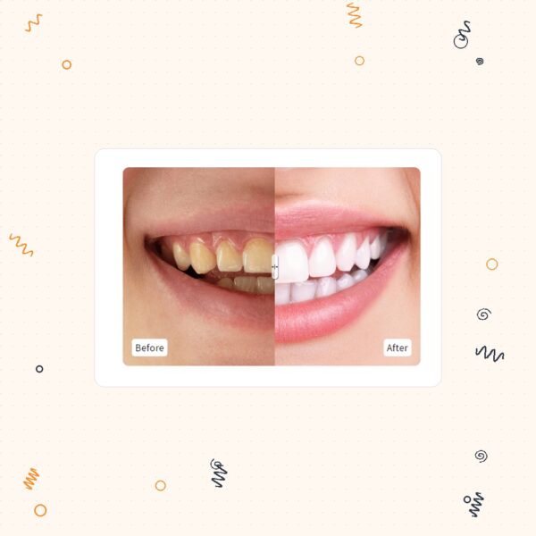 Before & After Comparison